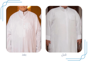 أخصائي تكميم المعدة في البحرين | مستشفى السلام التخصصي
