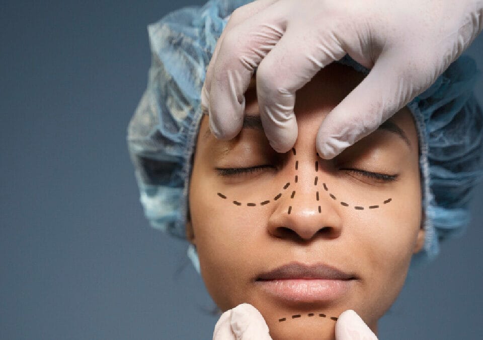 قبل وبعد جراحة التجميل
