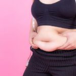 gastric sleeve