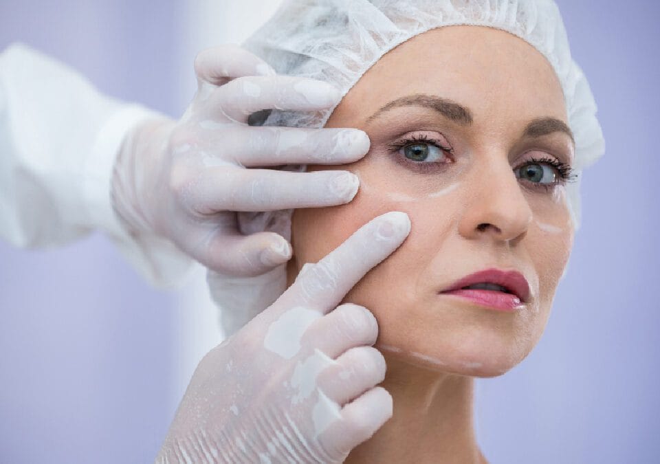 جراحة التجميل
